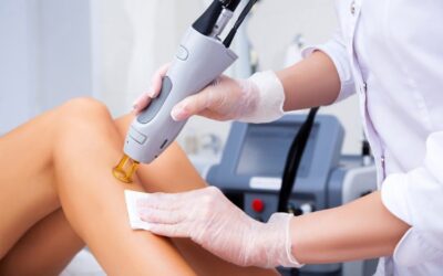 5 Dicas Para Uma Depilação a Laser Bem Sucedida